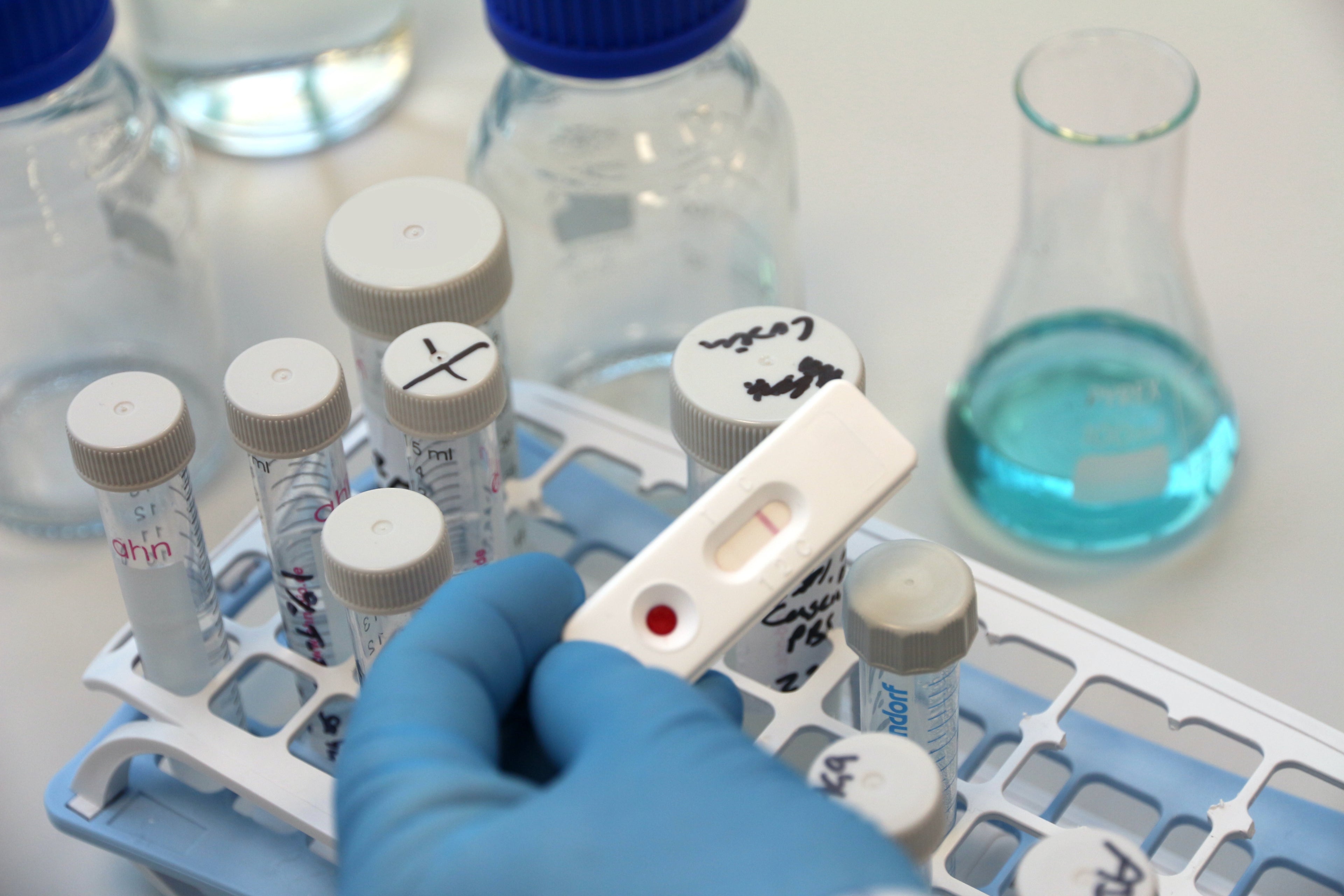 Laboratory setting with a scientist holding a SELFCHECK self-test cassette in a blue gloved hand, showing area where blood has been added and a negative single line result. On the lab bench are test tubes and bottles.